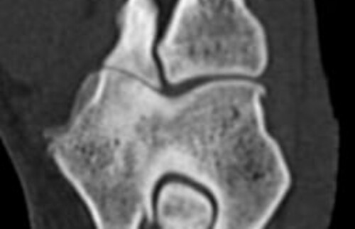 Schwarz-weiss R&ouml;ntgenaufnahme