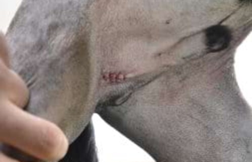 Operationsnarbe nach erfolgreicher Operation.