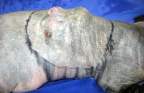 Gro&szlig;es, bereits infiltratives Fibrosarkom.