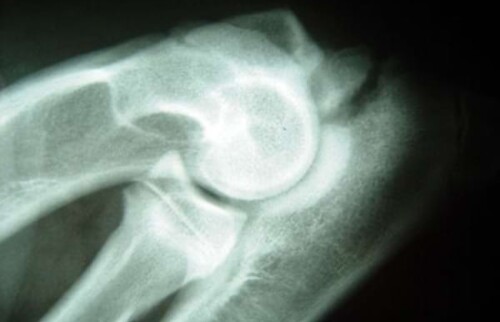 Berner Sennenhund, m&auml;nnlich, 6 Monate: Ellbogen in gebeugter Haltung. Der Isolierte Prozessus Anconaeus wird &uuml;berlagerungsfrei dargestellt.