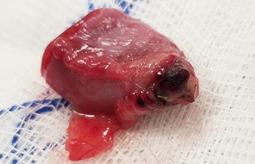 Perforation des cranialen Blasenpols