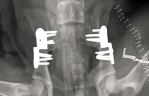 Bild einer beiderseitigen DPO.