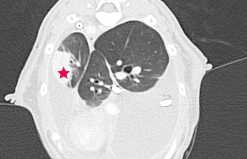 Strukturelle Lungenver&auml;nderung (Stern)