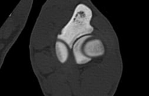 Schwarz-weiss R&ouml;ntgenaufnahme