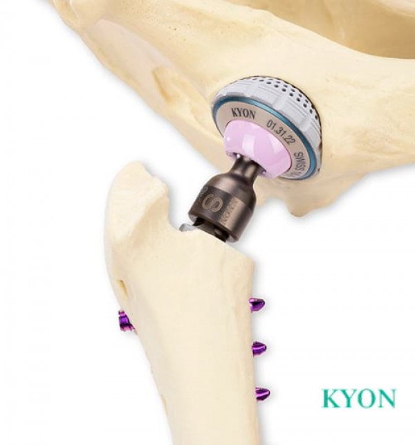 Kyon H&uuml;ftimplantat f&uuml;r moderne H&uuml;ftoperationen bei Hund und Katze