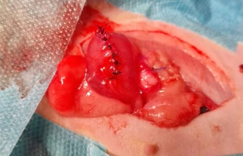 Verbliebener Harnblasenanteil nach Dichtigkeitspr&uuml;fung