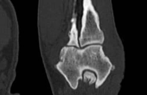 Schwarz-weiss R&ouml;ntgenaufnahme