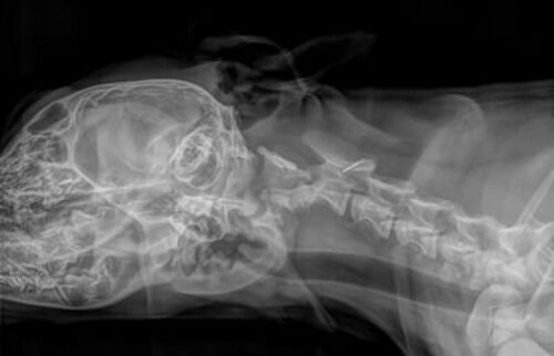 Abb. 1: Verdacht auf eine Fraktur des Wirbelk&ouml;rpers C2 und eine Subluxation von C2 nach dorsal im R&ouml;ntgen