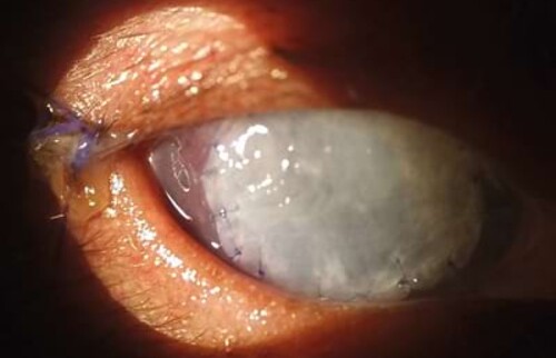 Kontrolle 3 Tage post OP