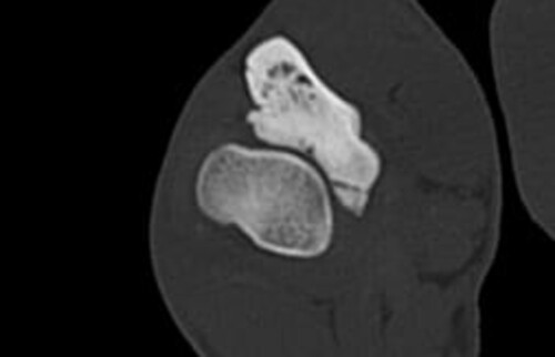 Schwarz-weiss R&ouml;ntgenaufnahme