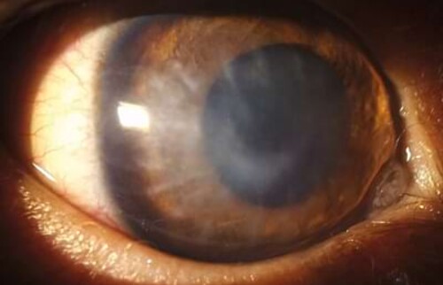 Abschlussuntersuchung 7 Wochen post OP - Willy weist zuhause keine Visuseinschr&auml;nkungen auf