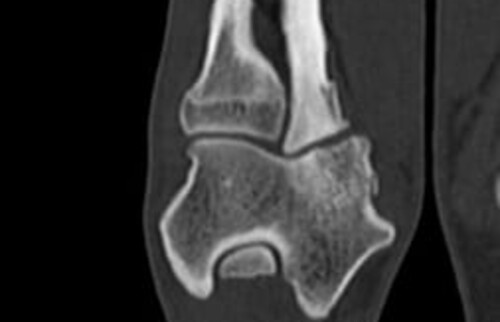 Schwarz-weiss R&ouml;ntgenaufnahme