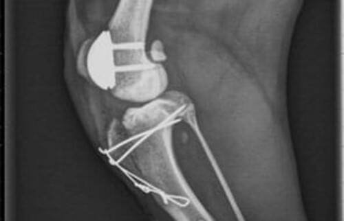 Die Korrektur der Kniescheibenlockerheit