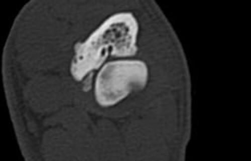 Schwarz-weiss R&ouml;ntgenaufnahme