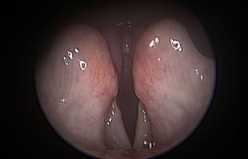 Kelhkopf&ouml;ffnung vor der Operation