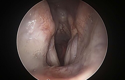 Kehlkopf&ouml;ffnung nach der Operation